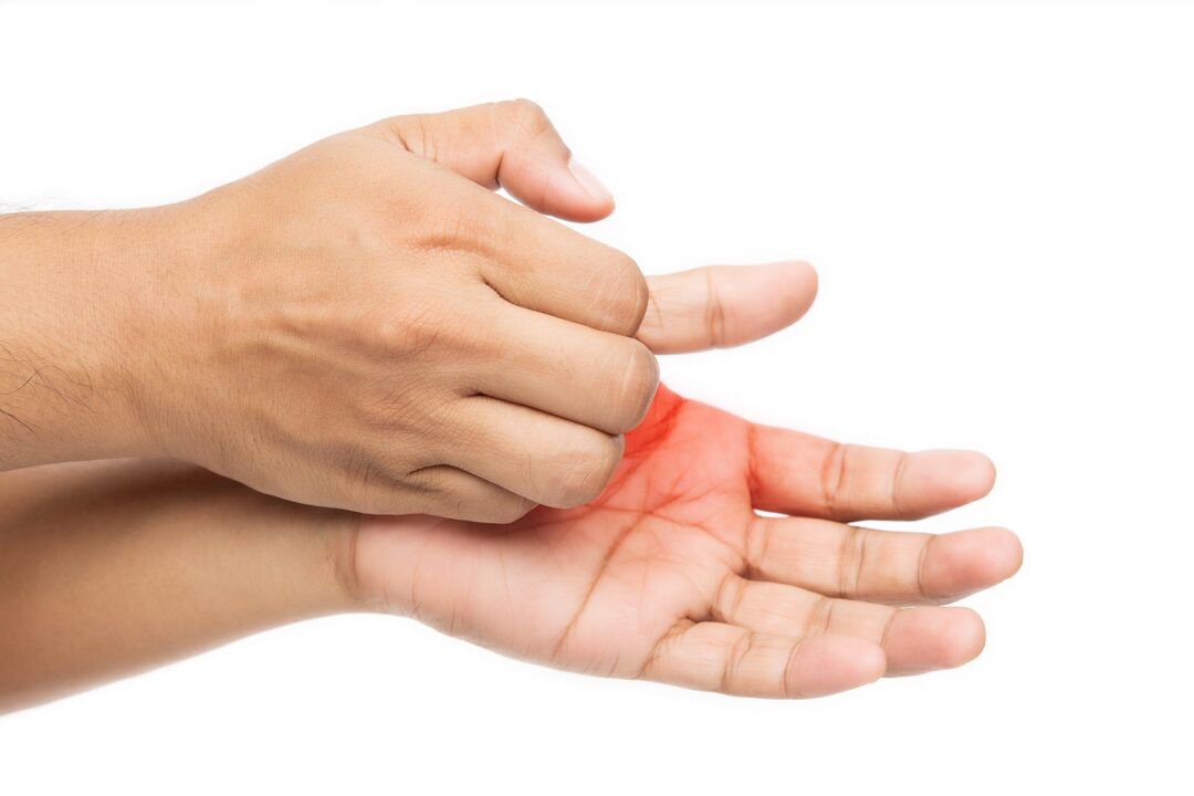 Κνησμός με μύκητα και τη θεραπεία του με κρέμα δημητίας